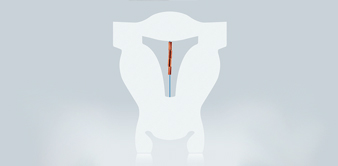 menstruationstasse gynefix